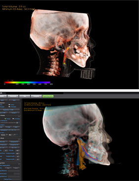 3D ANALYSIS / 진단용 PPT 제작 사례